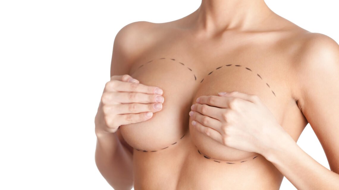 Tout savoir sur la reconstruction mammaire et ses avantages