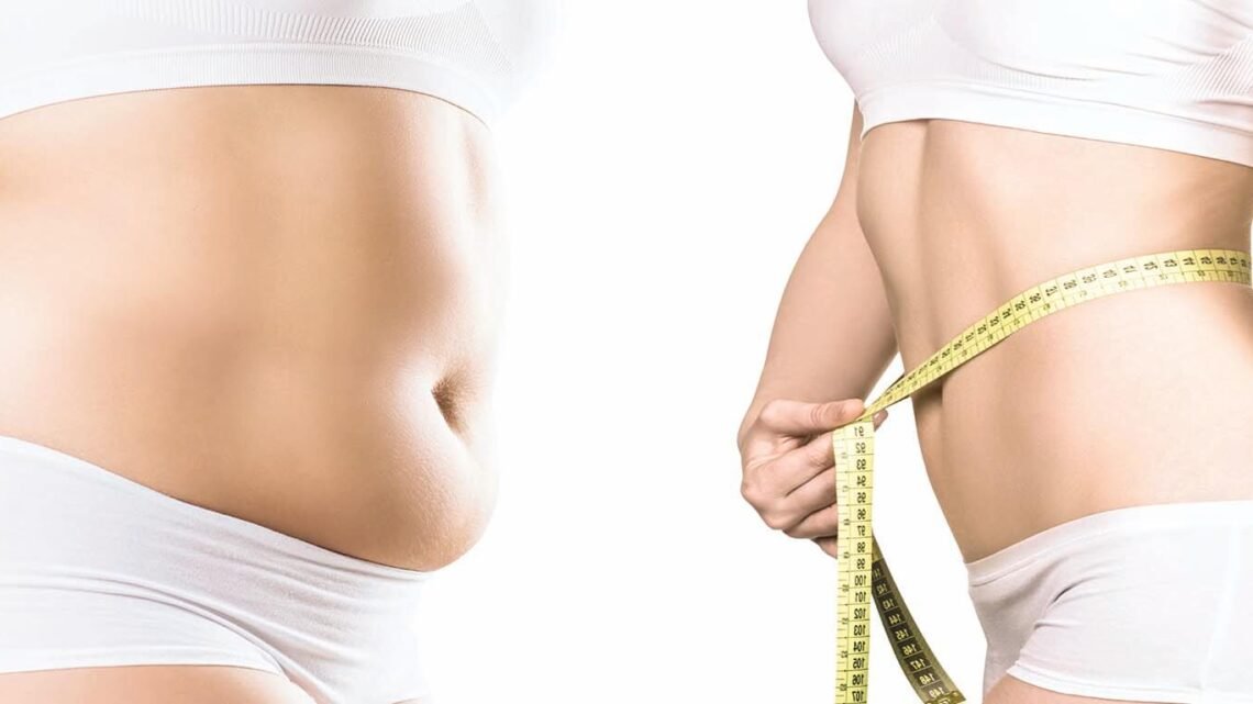 Body contouring : Tout savoir sur la chirurgie remodelage du corps