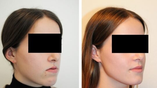 chirurgie esthétique faciale