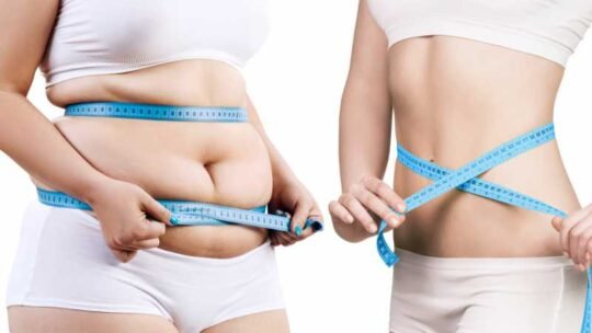 Liposuccion : Tout savoir sur la lipo